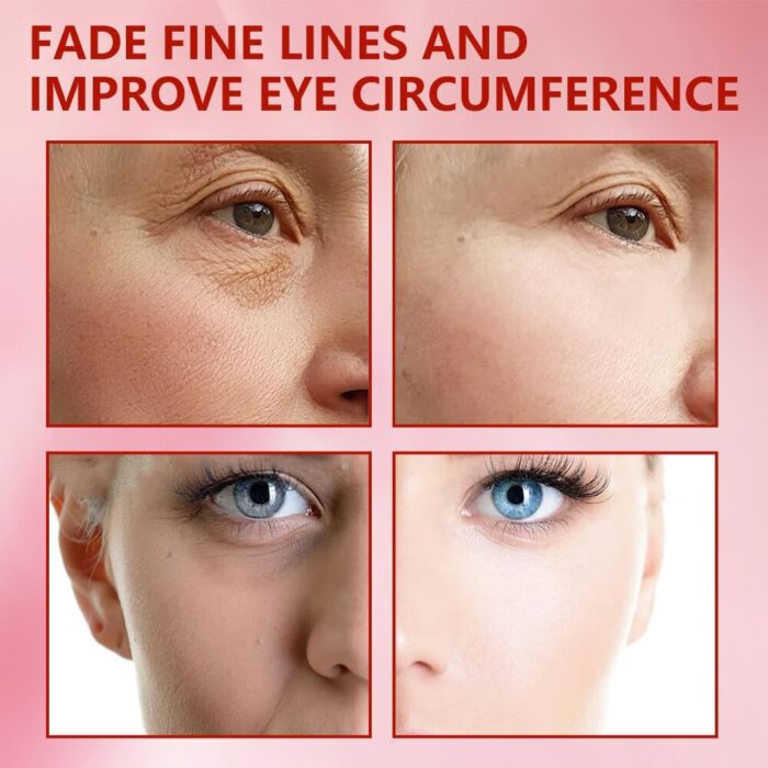 Masajeador facial con frío y calor antiarrugas rosa